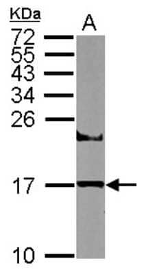 Western Blot: HR6A/UBE2A Antibody [NBP2-20780]