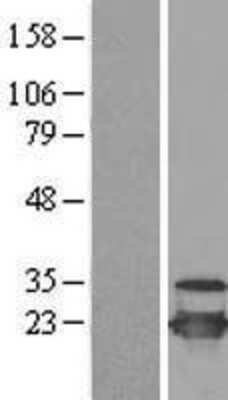 Western Blot: UbcH10/UBE2C Overexpression Lysate [NBL1-17514]