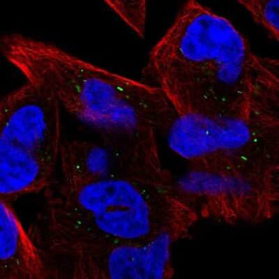 Immunocytochemistry/ Immunofluorescence: UBE2CBP Antibody [NBP1-86757]