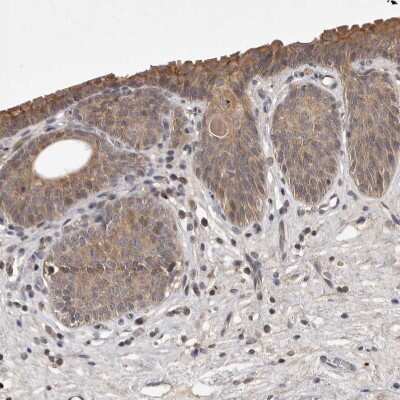Immunohistochemistry-Paraffin: UBE2CBP Antibody [NBP1-86757]