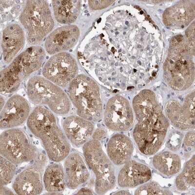 Immunohistochemistry-Paraffin: UBE2CBP Antibody [NBP1-86757]