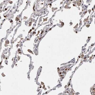 Immunohistochemistry-Paraffin: UBE2CBP Antibody [NBP1-86757]