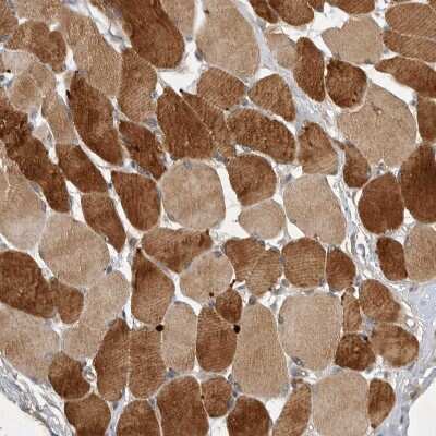 Immunohistochemistry-Paraffin: UBE2CBP Antibody [NBP1-86757]