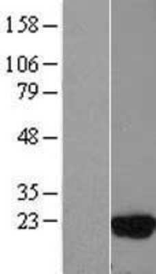 Western Blot: UbcH5c/UBE2D3 Overexpression Lysate [NBL1-17521]