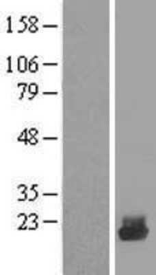 Western Blot: UBE2D4/Ubch5d Overexpression Lysate [NBL1-17523]