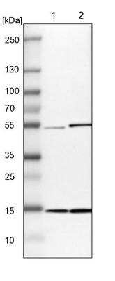 Western Blot: UbcH5b/UBE2D2 Antibody [NBP1-81769]