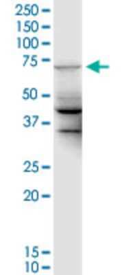 Western Blot: UBE2DNL Antibody (2F7) [H00340561-M01]