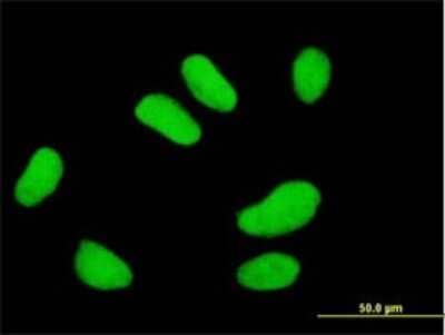 Immunocytochemistry/ Immunofluorescence: UBE2E2 Antibody (4B4) [H00007325-M01]