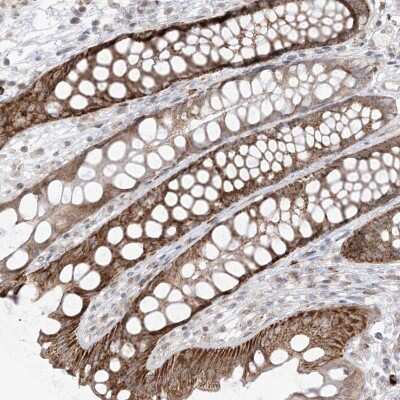 Immunohistochemistry-Paraffin: UBE2E2 Antibody [NBP1-92556]
