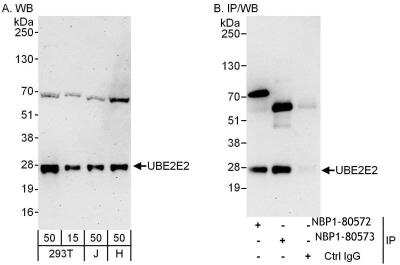 Immunoprecipitation: UBE2E2 Antibody [NBP1-80572]