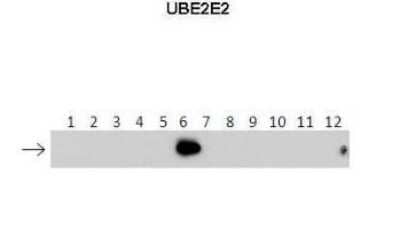 Western Blot: UBE2E2 Antibody [NBP1-55077]