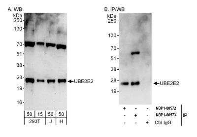 Western Blot: UBE2E2 Antibody [NBP1-80573]