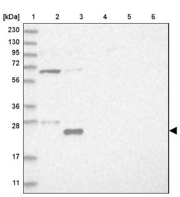 Western Blot: UBE2E2 Antibody [NBP1-92556]
