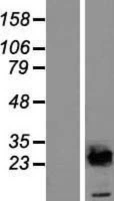 Western Blot: UBE2E2 Overexpression Lysate [NBL1-17524]