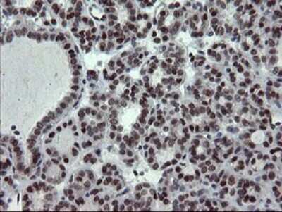 Immunohistochemistry: UBE2E3 Antibody (OTI1B4) [NBP2-46271]