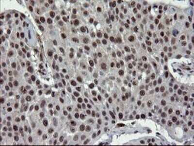 Immunohistochemistry: UBE2E3 Antibody (OTI1B4) [NBP2-46271]