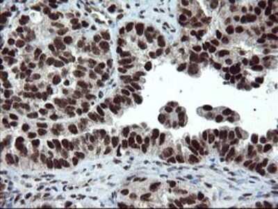 Immunohistochemistry: UBE2E3 Antibody (OTI1B4) [NBP2-46271]