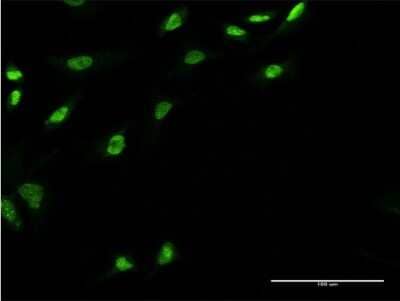 Immunocytochemistry/ Immunofluorescence: UBE2E3 Antibody (3E9) [H00010477-M05]