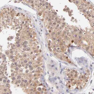 Immunohistochemistry-Paraffin: UBE2E3 Antibody [NBP1-86884]