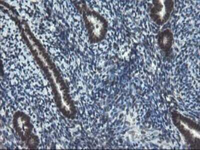 Immunohistochemistry: UBE2E3 Antibody (OTI1B4) - Azide and BSA Free [NBP2-74737]