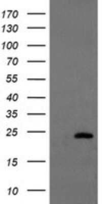 Western Blot: UBE2E3 Antibody (OTI1B4)Azide and BSA Free [NBP2-74737]