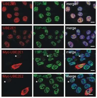 Immunohistochemistry: UBE2E3 Antibody (OTI7E8) - Azide and BSA Free [NBP2-74745]
