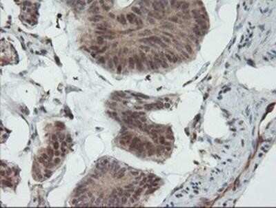 Immunohistochemistry: UBE2E3 Antibody (OTI7E8) - Azide and BSA Free [NBP2-74745]