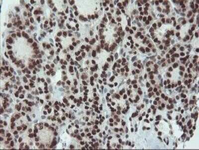 Immunohistochemistry: UBE2E3 Antibody (OTI7E8) - Azide and BSA Free [NBP2-74745]