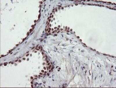 Immunohistochemistry: UBE2E3 Antibody (OTI7E8) - Azide and BSA Free [NBP2-74745]