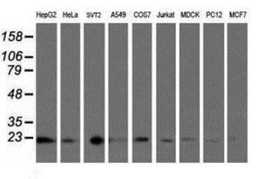Western Blot: UBE2E3 Antibody (OTI7E8)Azide and BSA Free [NBP2-74745]