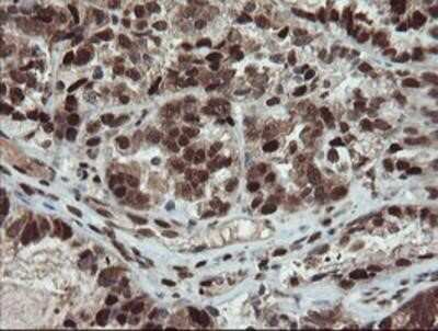 Immunohistochemistry-Paraffin: UBE2E3 Antibody (OTI7E8) [NBP2-03819]