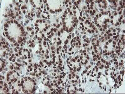 Immunohistochemistry-Paraffin: UBE2E3 Antibody (OTI7E8) [NBP2-03819]