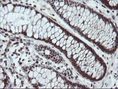 Immunohistochemistry-Paraffin: UBE2E3 Antibody (OTI7E8) [NBP2-03819]