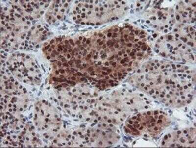 Immunohistochemistry-Paraffin: UBE2E3 Antibody (OTI7E8) [NBP2-03819]