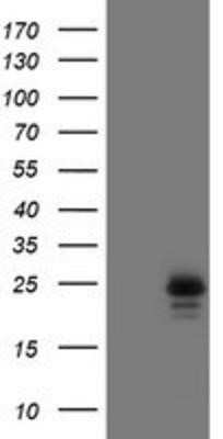 Western Blot: UBE2E3 Antibody (OTI7E8) [NBP2-03819]