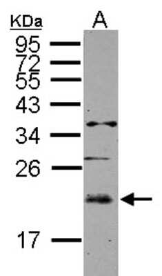 Western Blot: UBE2E3 Antibody [NBP2-20784]