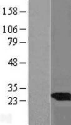 Western Blot: UBE2E3 Overexpression Lysate [NBL1-17526]