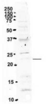 Western Blot: UBE2F/NCE2 Antibody [NBP1-57602]