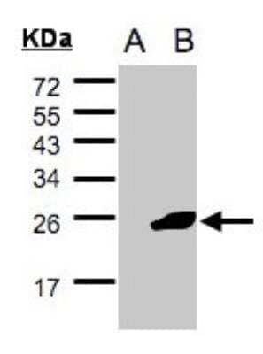 Western Blot: UBE2F/NCE2 Antibody [NBP2-19292]