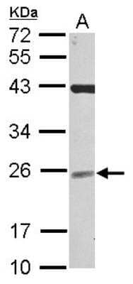 Western Blot: UBE2F/NCE2 Antibody [NBP2-19485]