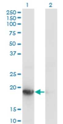 Western Blot: UBE2G1 Antibody (1C12-1B2) [H00007326-M01]