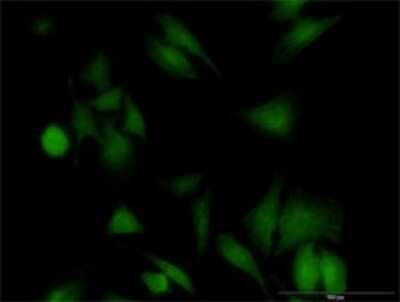 Immunocytochemistry/ Immunofluorescence: UBE2G1 Antibody (2A9-1F11) [H00007326-M02]