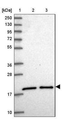 Western Blot: UBE2G1 Antibody [NBP2-13499]