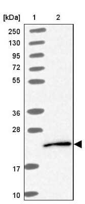 Western Blot: UBE2G1 Antibody [NBP2-13500]