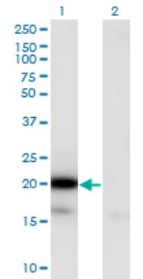 Western Blot: UBE2G2 Antibody (5E1) [H00007327-M01]
