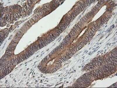 Immunohistochemistry: UBE2G2 Antibody (OTI1B10) - Azide and BSA Free [NBP2-74746]