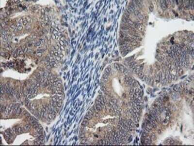 Immunohistochemistry: UBE2G2 Antibody (OTI1B10) - Azide and BSA Free [NBP2-74746]