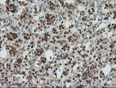 Immunohistochemistry: UBE2G2 Antibody (OTI1B10) - Azide and BSA Free [NBP2-74746]