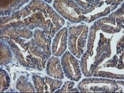 Immunohistochemistry: UBE2G2 Antibody (OTI1B10) - Azide and BSA Free [NBP2-74746]