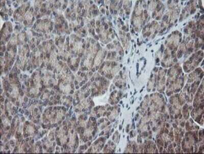 Immunohistochemistry: UBE2G2 Antibody (OTI1B10) - Azide and BSA Free [NBP2-74746]